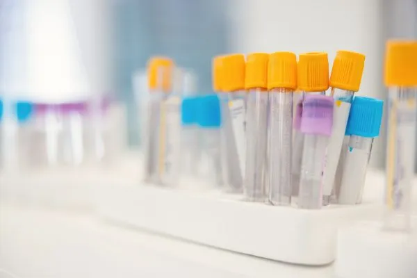 Veterinary lab sample tubes used for parasite testing through Camp Happy Paws’ partnership with<br />Canine Lab Testing and Antech